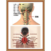 颈椎疾病 饰画脊柱挂图 危害肩颈保养中医养生馆宣传海报美容院装