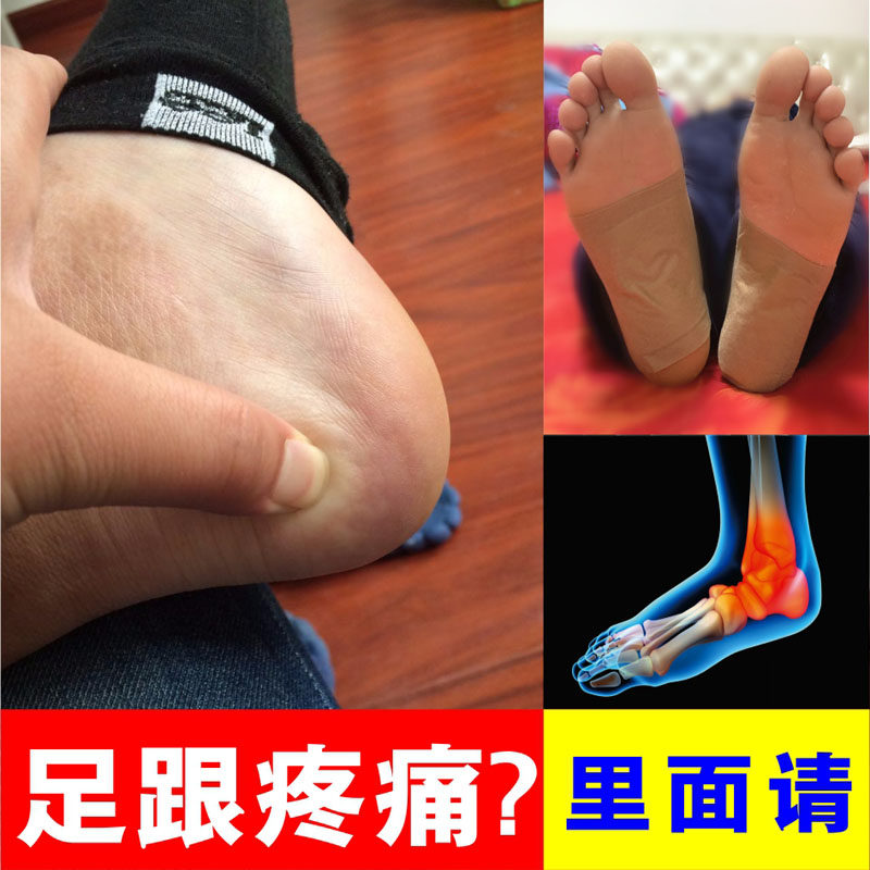 足跟痛贴膏脚跟疼跟腱炎贴脚后跟痛筋膜膏产后足跟痛宁消贴安康膏