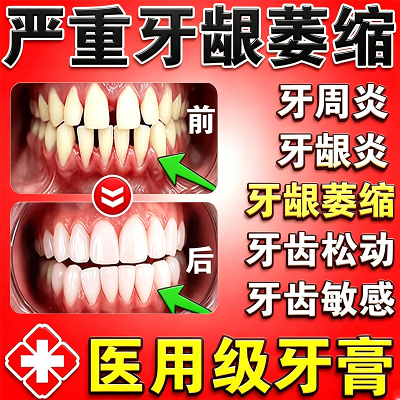 牙龈萎缩修复再生专用牙膏牙齿松动固齿专用药牙齿敏感酸痛牙膏药