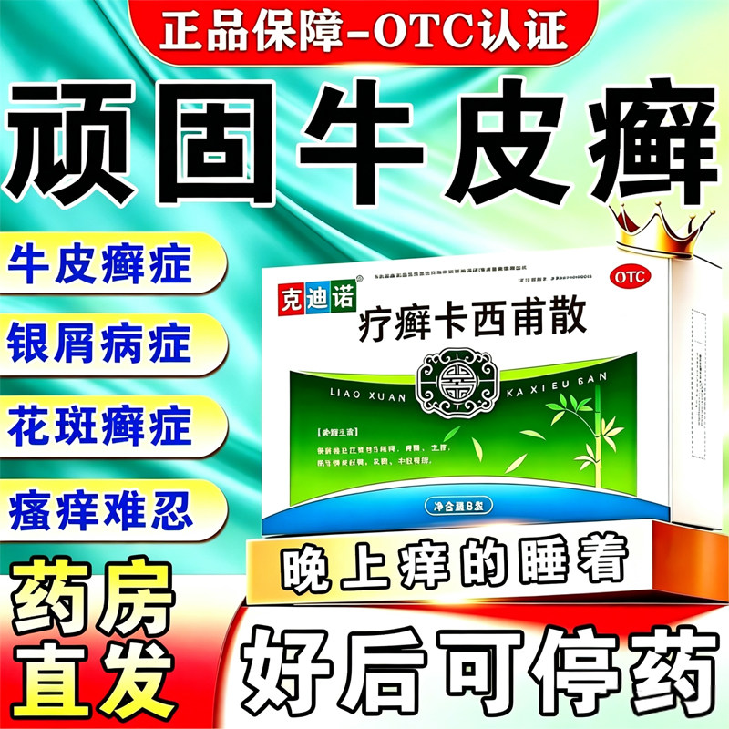 顽固牛皮癣银屑病专用药真菌感染特新效药疗癣卡西甫散官方旗舰店