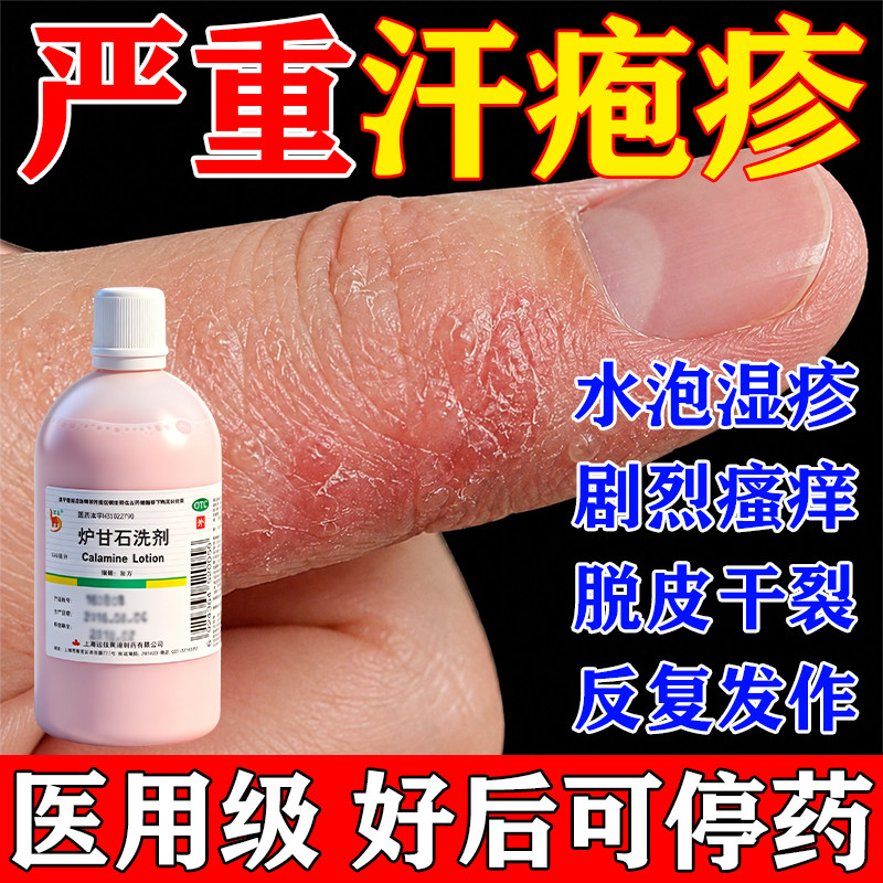 【信龙】炉甘石洗剂5%5%15%*100ml/瓶