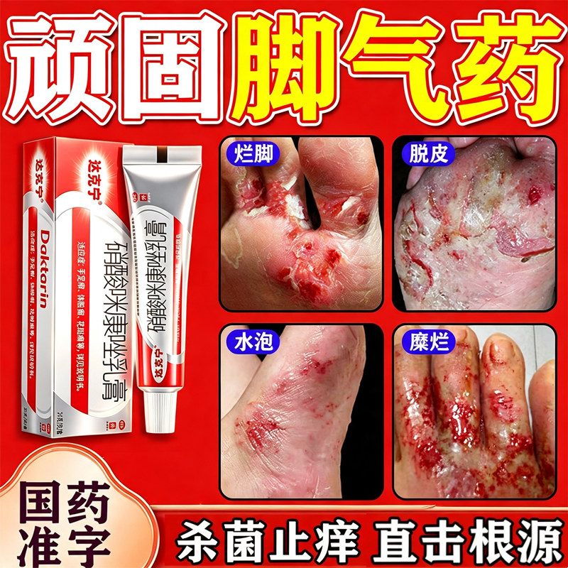 达克宁正品脚气止痒脱皮杀真菌感染水泡特专用效药烂脚丫糜烂脚趾