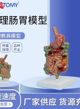 P病NT-0767理549肠胃模型大肠病模变型肠道疾病人体结肠病变模型
