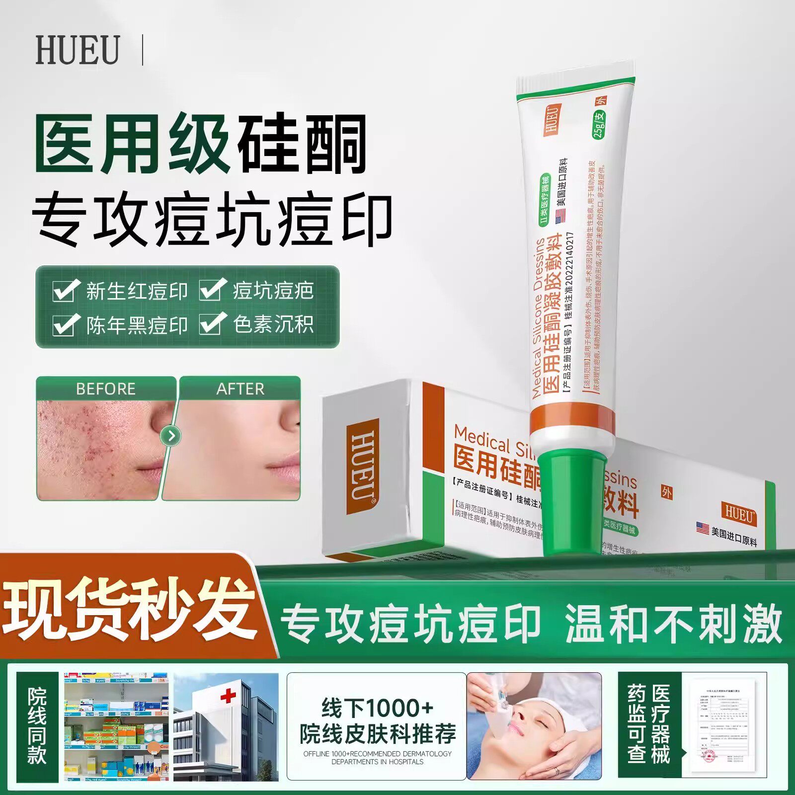hueu硅酮凝胶【官方正品】hue硅酮敷料hue硅凝胶hue硅酮凝胶痘印