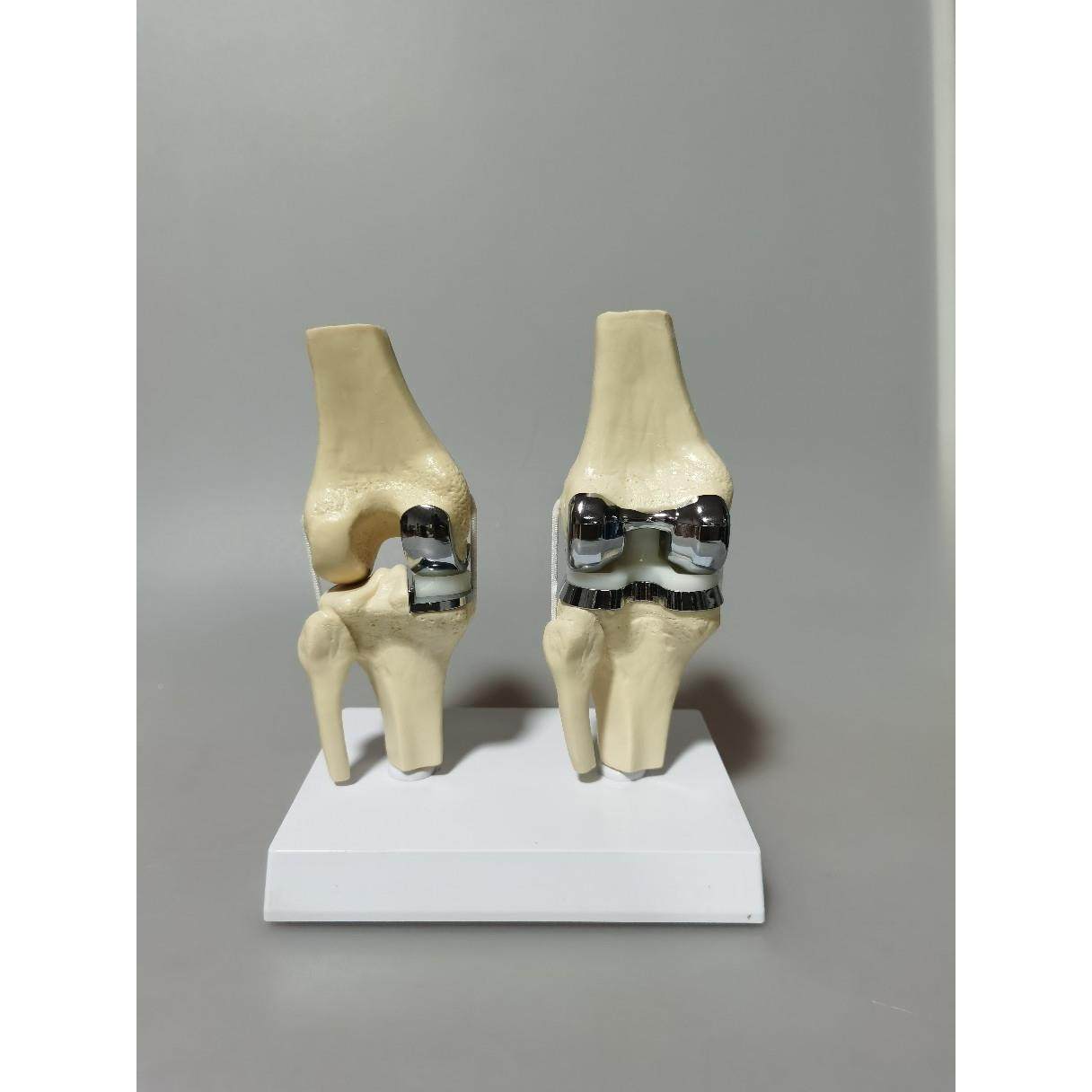 双关无品牌/膝模节型,文具电教/文化用品/商务用品,教学标本/模型,淘宝优惠券,粉丝福利购,淘宝优惠卷