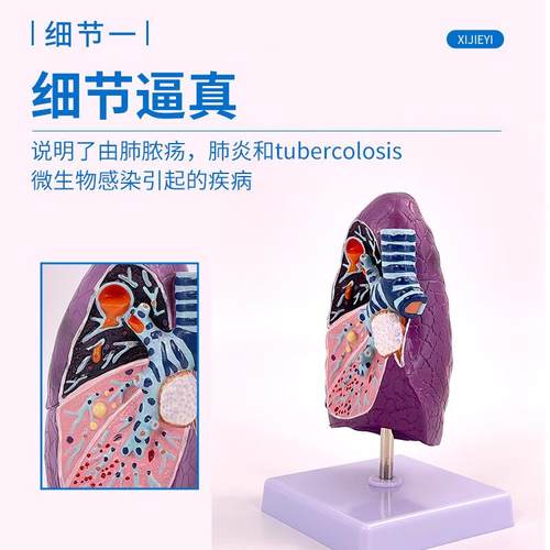 人体273气管和肺解剖肺病理肺模型吸烟肺切者面内科呼吸系统模型