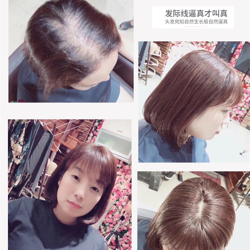 小函假发夏季假发片直发头顶补发片女遮盖白发网红法式刘海假发