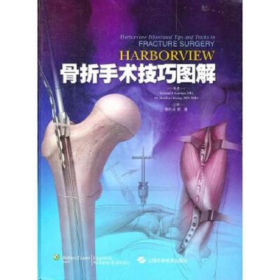 库存九成新Harborview 骨折手术技巧图解 9787547807194 （美）加德纳,（美）亨利著,张长青,张伟译 上海科学技术出版社