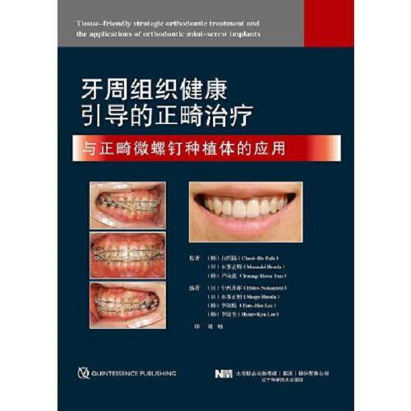 正版库存书9787559115911 牙周组织健康引导的正畸治疗于正畸微螺钉种植体的应用 (日)中西秀郎(HideoNakanishi)(日)本多正
