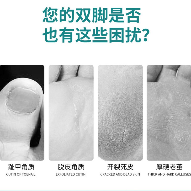 扬州三把修脚刀套装技师专业修脚套装甲沟钳去死皮刨刀老茧扦脚刀