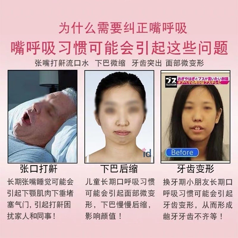 口呼吸矫正带防止嘴巴张开流口水闭嘴神器防睡觉张嘴止鼾带成人