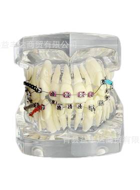 M3005-3矫正牙齿模型透明色正畸模型牙齿矫正模型