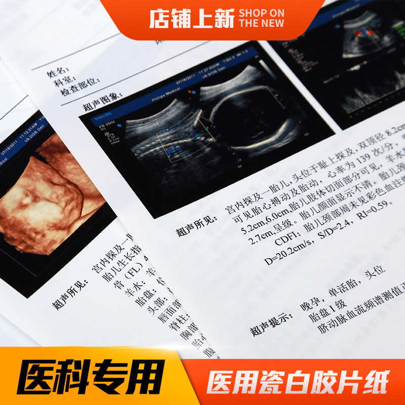 医院用彩超胶片瓷白喷墨胃肠镜四维B超打印纸胶片激光半透明胶片