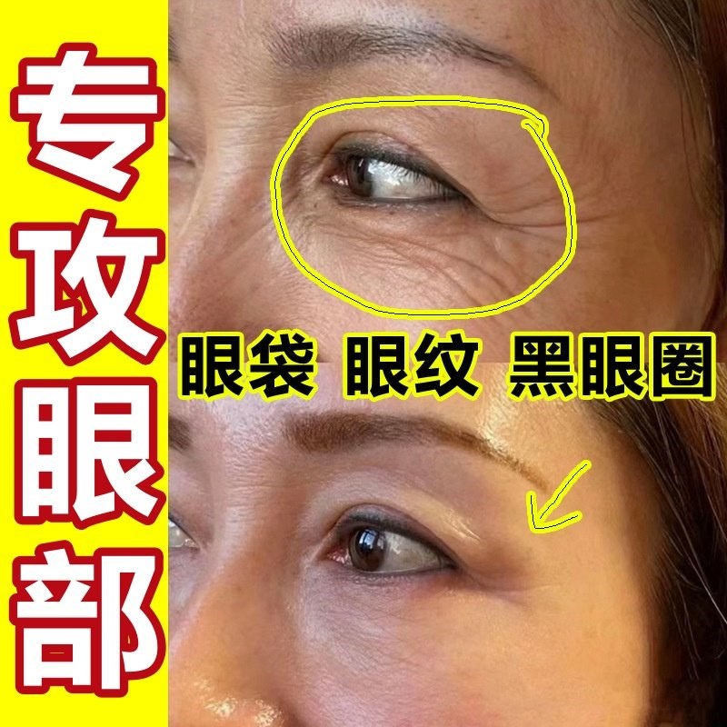 【2025新款】6D凝水微晶眼膜提拉紧致消黑眼圈眼袋细纹非小工具