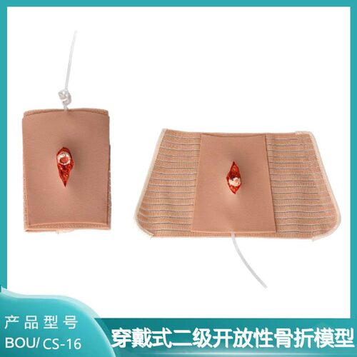 穿戴式二级开放性骨折模型
