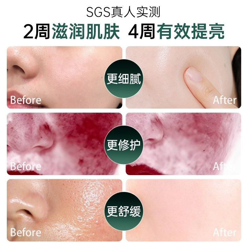 注氧仪高压纳米喷雾补水仪家用蒸脸部美容仪器精华导入纳米水光仪