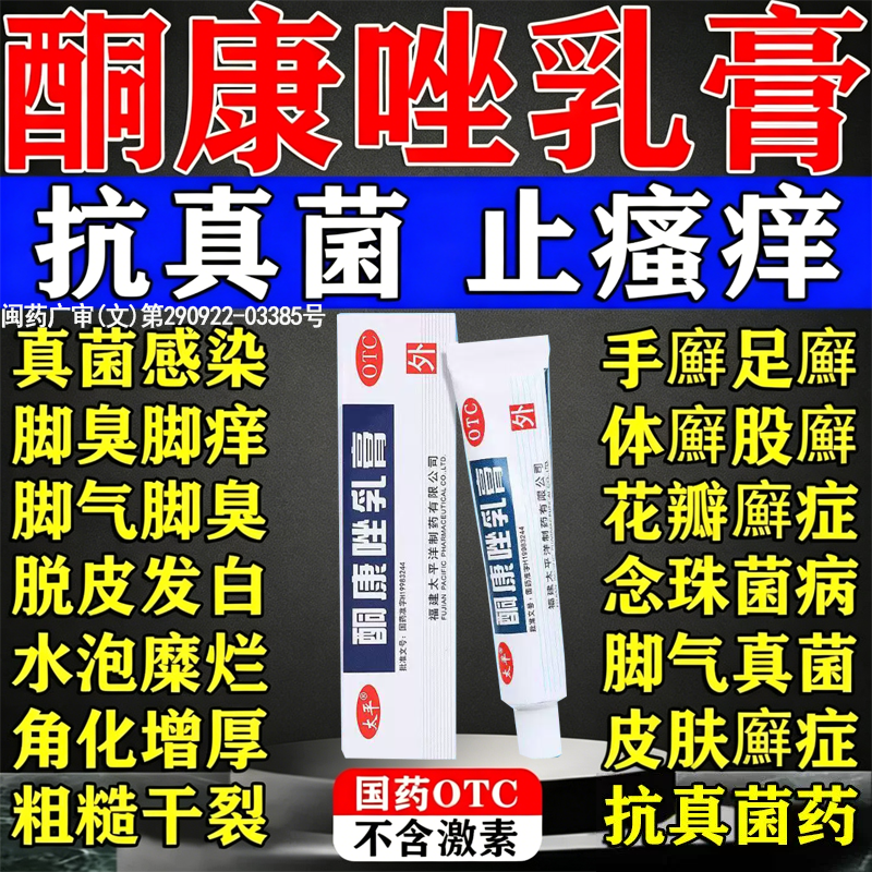 酮康唑乳膏正品药治疗脚气止痒足藓专用药膏抗真菌性毛囊炎痘痘