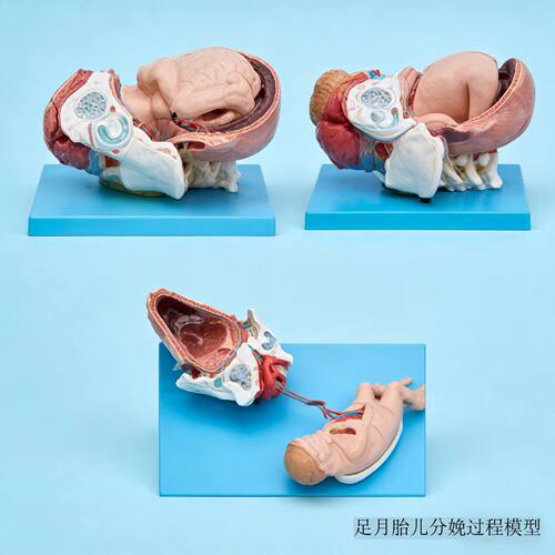 足月胎儿分娩过程模型