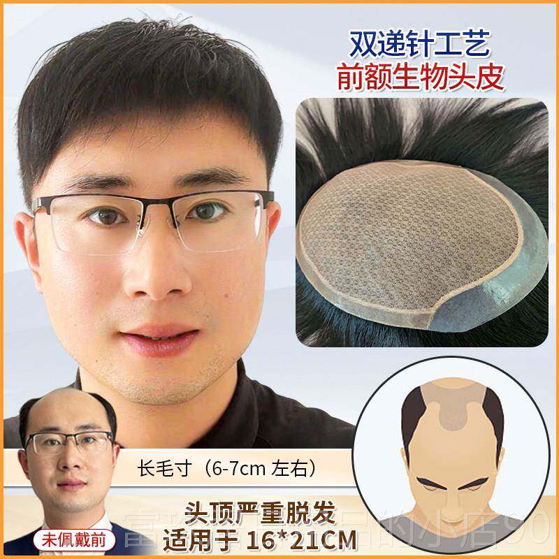 高档假发男针士双递真发彷真隐生头形顶补发片全手织地中海秃头男