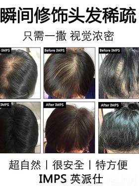高档IMPS发际线 线填浓密增多美发补发神充器发增发假粉头发发少