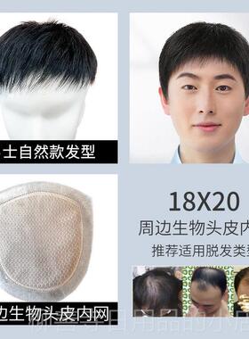 正品男士假定发头顶补发片隐式形痕真发假发片男短发男补发块无发