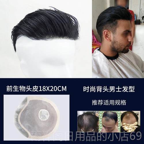 正品男假发头顶补发隐形无真发假发片痕男短发男式补发士块发片定