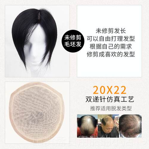 高档男士假头补顶发男短针真发补发块前额发发际线隐形无痕生物递