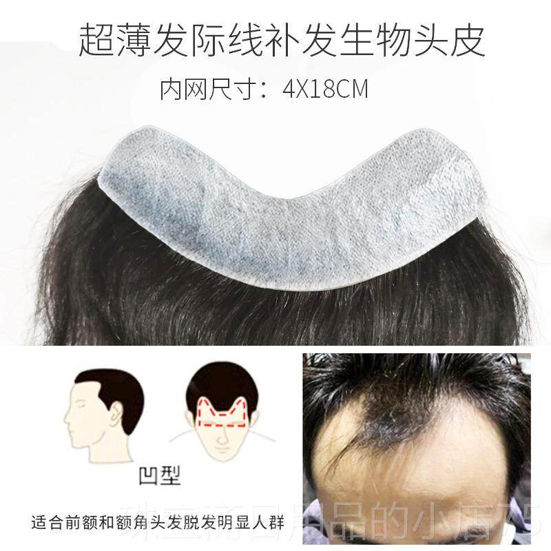 高档男士前额假发际线假发贴刘海前额m型无海生物头皮刘补发片隐
