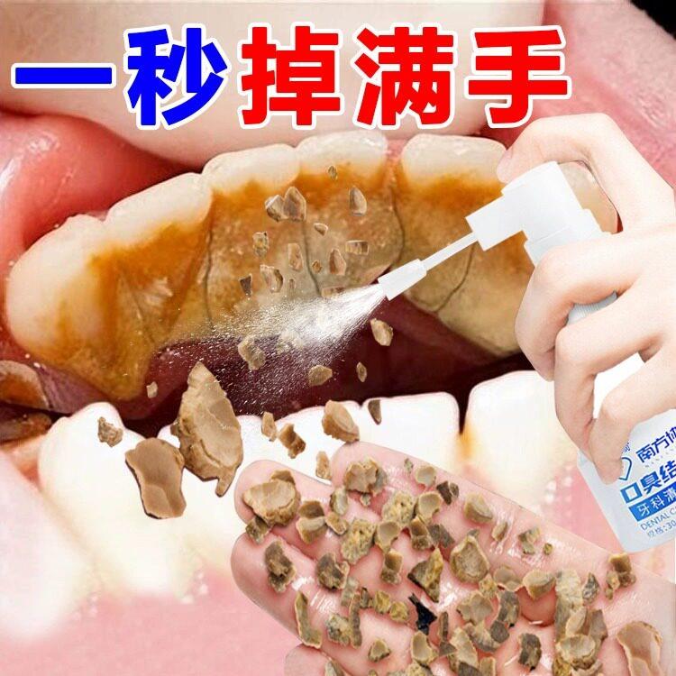 小红书爆款】去结石烟渍茶渍 牙齿污垢清洁 男女通用
