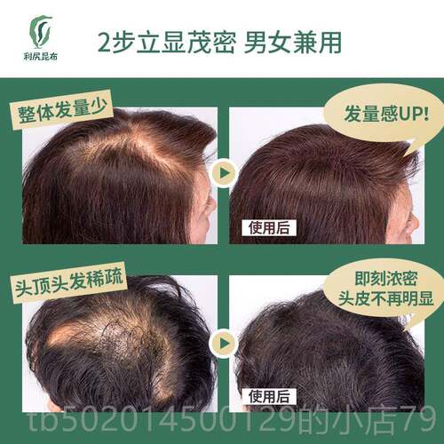 高档日本利尻昆纤布发维粉+定发型喷雾际线假发补增发增发密发神