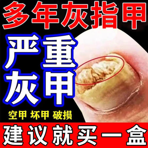 【白云山】盐酸特比萘芬乳膏1%*18g*1支/盒