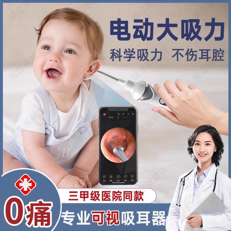 电动耳垢吸除工具,为婴儿和儿童去除油耳,安全清洁和发光挖勺,