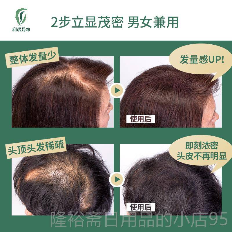 高档日纤本利尻昆布发维增+定型喷雾发际线假发补发增发密粉发神