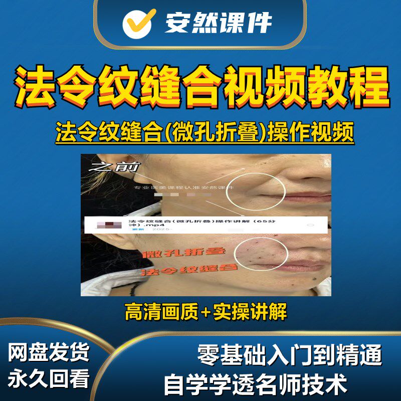 法令纹缝合微孔筋膜折叠非手术埋线提拉非注射操作讲解参考视频