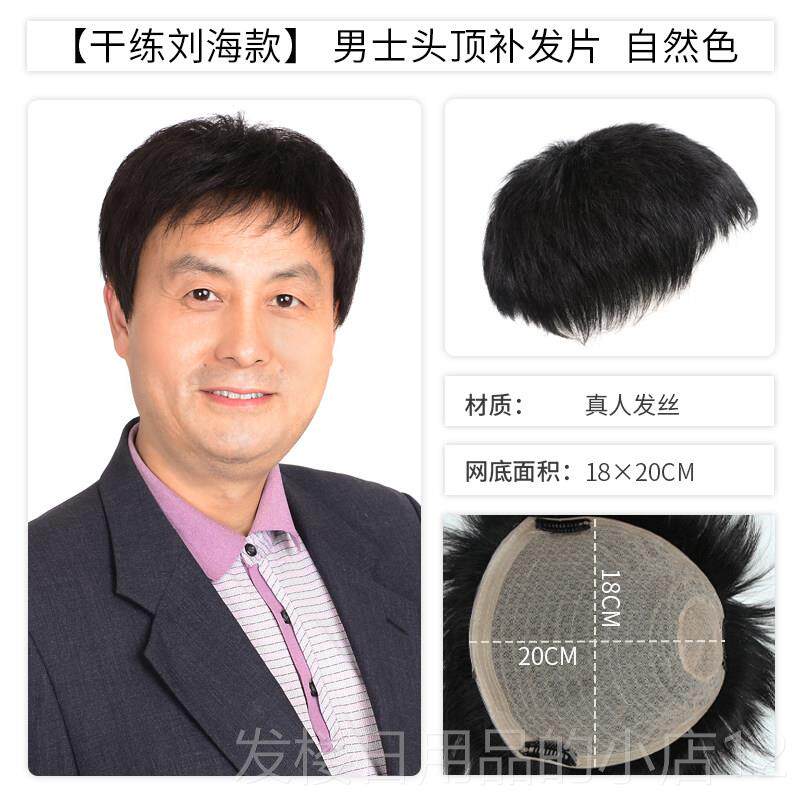 正品织顶发发男士补前额发隐形无痕真人发补发际线秃补发片补头顶