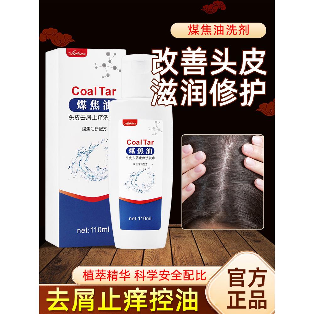 煤焦油洗发水洗剂官方正品头屑改善控油洗发水清洁毛囊头脂溢性