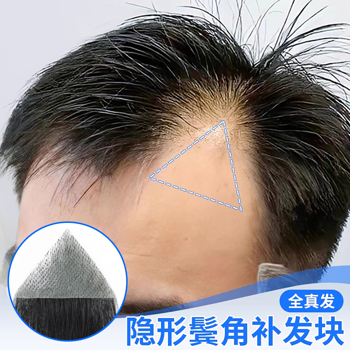 男士假刘海片鬓角补发假发片男女全真人发m型前额发际线假发贴片