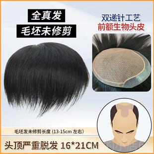 高档假发男双头递针真发真隐形顶补发片全手织地中海秃头男士生补