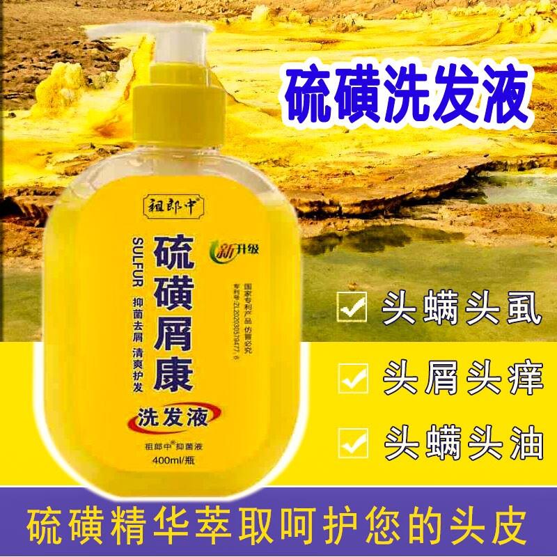 硫磺皁上海洗发精升级去头蟎脂溢性头皮屑控油毛囊国货洗发水