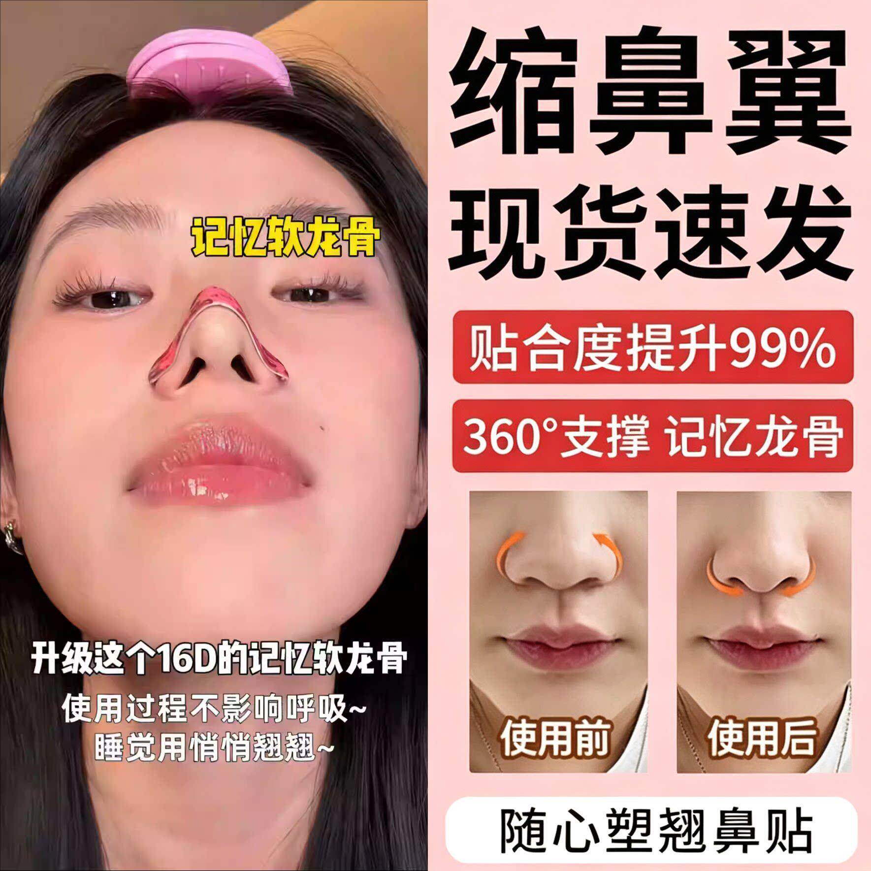 可调节翘妙鼻贴弯折收紧塌鼻梁大鼻翼缩小矫正鼻子塑形鼻夹贴