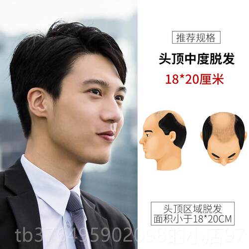 新款男士假短发帅发气韩版头顶补发片偏分秃顶真前额中老年男式发