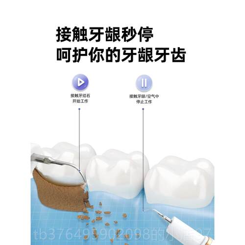 新款趣健乐洁器超牙声波洁齿牙器除牙石牙去垢冲牙器家用洗牙器牙