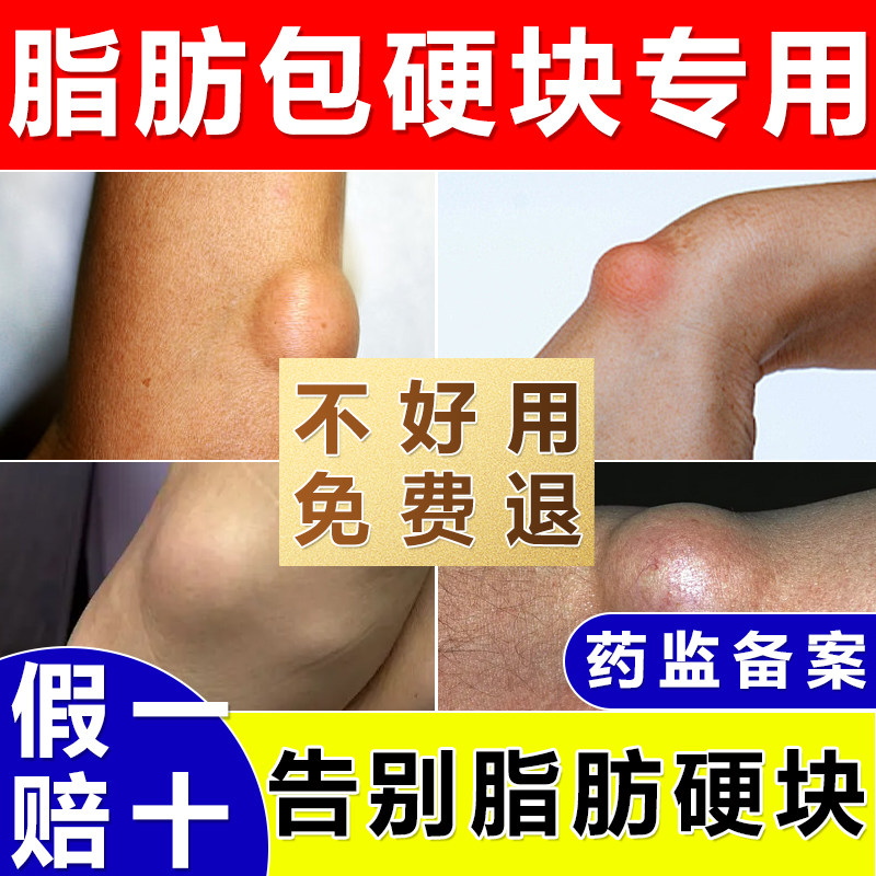 陈九玄医用聚乙二醇护创敷料顽固脂肪包疙瘩皮下囊肿正品保障S9