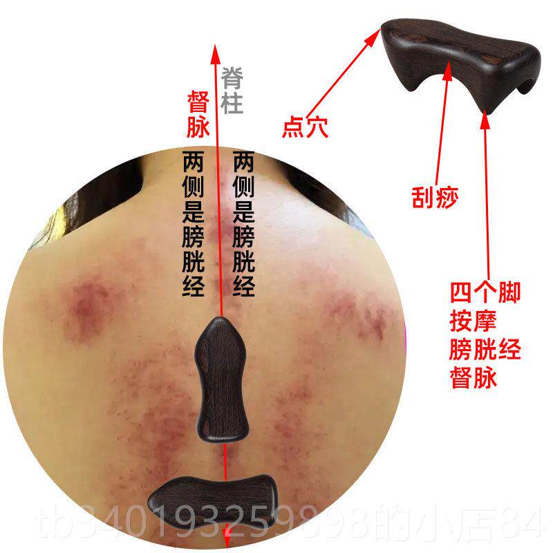 新款经络按摩推拿部按摩工狗具按背经络疏通按摩器动力虎脊柱摩器