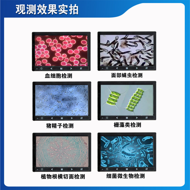 测恩超清一生血检测仪器血细胞检道猪精子水产养殖滴物双目显微镜