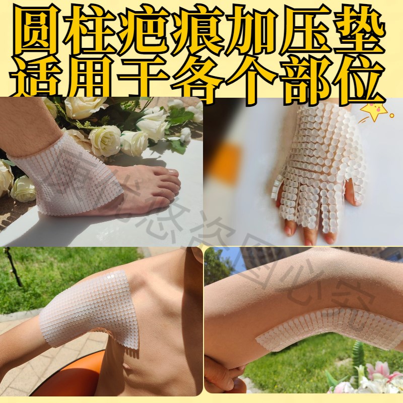 3D圆柱疤痕加压垫压烫伤儿童医贴术后凸起防增压生用硅凝胶增烧垫
