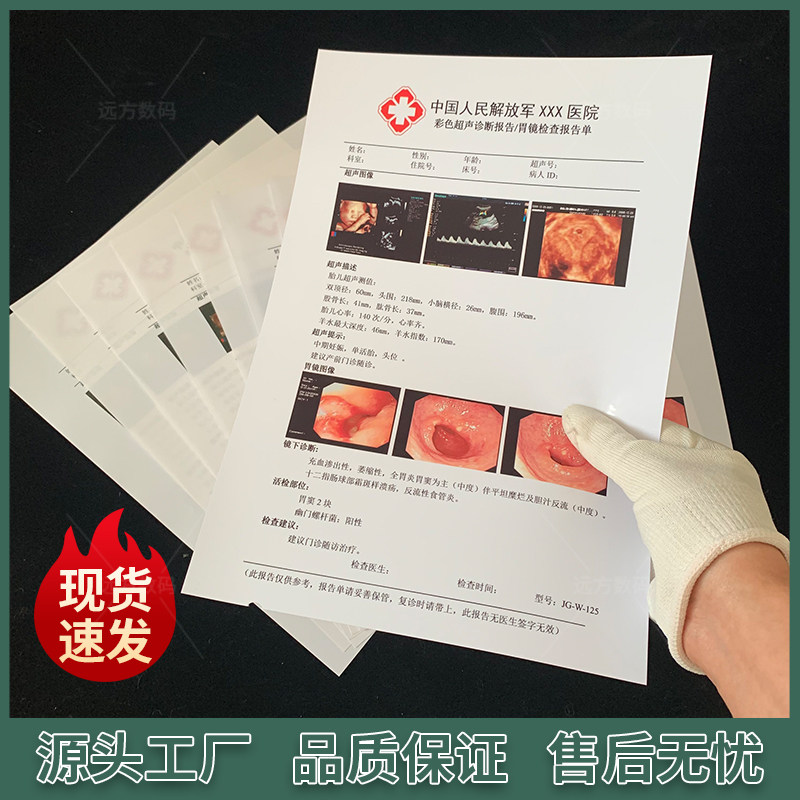 彩超胶片胃镜胶片三维重打胶片瓷建喷墨胶片彩超打印纸B超白印纸