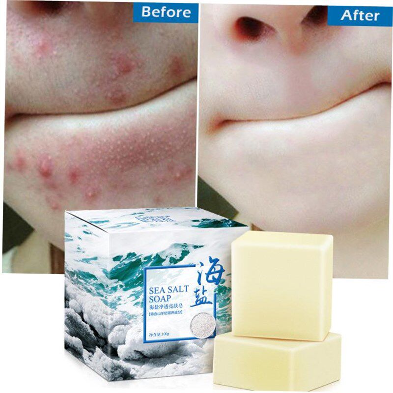 Sea Salt Cleaner oil control Anti acne treatment body Soap
