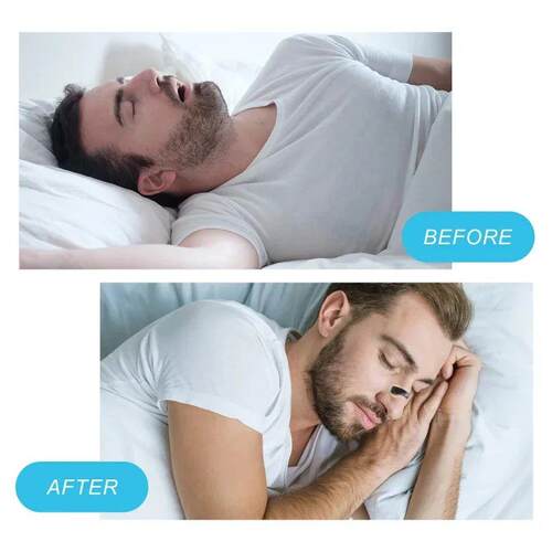 5/15/30days Magnetic Nasal Dilator Starter Kits Increase Air