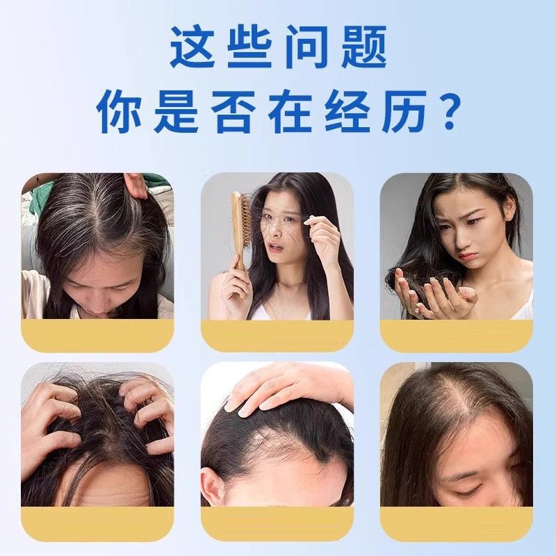 深海鱼油防止顺掉脱发百头GSX乌发柔风乌和鱼油国药w草本鱼油h